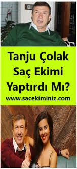 Eski Golculerden Tanju Colak In Saclarini Herkes Bilir Biraz On Kisimlarda Seyreklik Vardir Tanju Colak In Bu Az Acikligi Icin Sac Ekimi Mukemmel Olur Tanju C In 2020