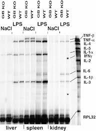 Последние твиты от jenny hellerud (@jennyhelle). Gelatinase B Deficiency Protects Against Endotoxin Shock Dubois 2002 European Journal Of Immunology Wiley Online Library