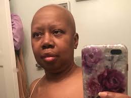 Fundraiser by Lisa Vassell : Medical Bills