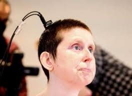 Brain-computer interfaces help two women speak again