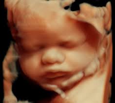 Ist ultraschall in der schwangerschaft gefährlich? 3d Ultraschall Fur Ihr Baby Mit Der Sanften Modernen Technik