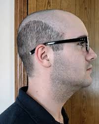 And for this year's homecoming skit, the Dameon Place of the Year Award  goes to...