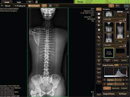 It seems, however, that the purification process of silicon does not. Cxdi 710c Cxdi 810c And Cxdi 410c Wireless Digital Radiography Systems Canon Medical Systems Usa
