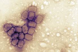 Image result for Smallpox