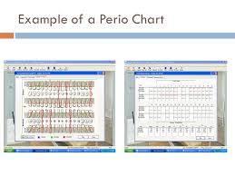 how to use eaglesoft a clinical dental software ppt video