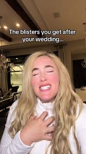 Dancing Induced Blisters vs. Running: A Comparison