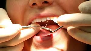 Private dentures can be made from a wide range of materials. My Nhs Dentist Can Fix My Son S Teeth If We Go Private Bbc News