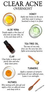 Natural Remedies To Clear Acne Overnight The Little Shine In 2020 Clear Acne Overnight Clear Acne Acne Overnight