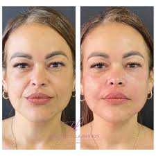 Dra Priscilla Barros