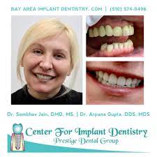 Pin On Before And After Dental Implants