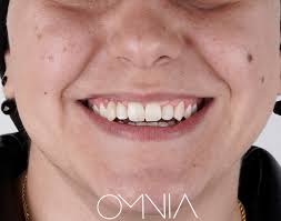 Uzm. Dt. Halil Toros Bingöl...