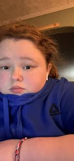 Happy FIF, ferals! Today is my birthday! I had surgery