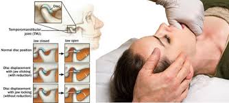 Tmj disorders affect the joint that connects the skull and the lower jaw, as well as the surrounding how to relieve a tight jaw. How You Can Treat Tmj Disorders With Osteopathy Ultimate Health Clinic
