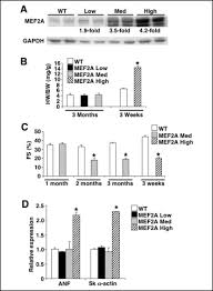 Lawyer & law firm in kuantan. Myocyte Enhancer Factors 2a And 2c Induce Dilated Cardiomyopathy In Transgenic Mice Journal Of Biological Chemistry