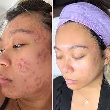 My girl 💕💕 @peyton.chambers #florencelashtech #nkylashtech #nkylashartist  #cincinnatilashartist #nkyclassiclashes #nkyhybridlashes #nkyvolumelashes  #cincinnatilashartist #florenceclassiclashes #edgewoodclassiclashes  #florencelashes #edgewoodeyelashes ...