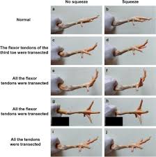 Image result for Squeeze Test