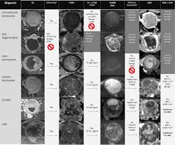 Image result for Leiomyosarcoma