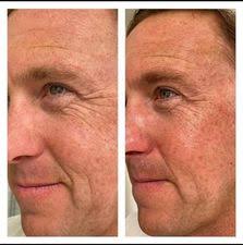 Need a firming cream for spring and summer?