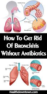 Pneumonia Remedies Pneumonia Remedies In 2020 Natural Remedies For Bronchitis Chest Infection Remedies Pneumonia Remedies