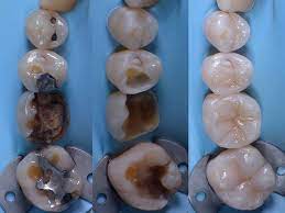 Pin En Dental