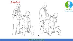 Image result for Yergason Test