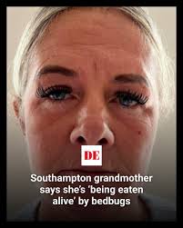 This makes my skin itch!