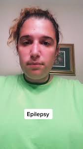 Samantha TikTok Videos Epilepsy