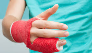 Når leddbåndene mellom leggen og foten blir skadet kaller vi den en forstuet fot blir ofte hoven på grunn av blødning. Brudd I Finger Og Hand Lommelegen