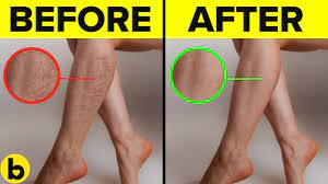 20 Proven Tips For Improving Blood Circulation - Youtube