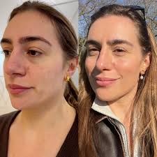 Is anyone missing a small white dog with a blue collar? Just spotted in a  garden