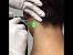 Laser Hair Removal For Men S Privates