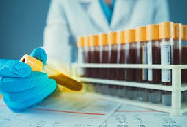 Check spelling or type a new query. What Is The Golden Blood Type