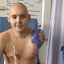 Fundraiser by Vinny fitzgerald : 3 peak challenge for Liam Chadwick and  christiesHP