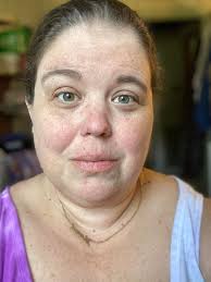 ☀️🌞 66 years old ,10 weeks after surgery! 👸💪 Tina lost 110 pounds over  the last 3 years. ⚡️💃 While she feels amazing and energized, her weight  loss accelerated her facial aging