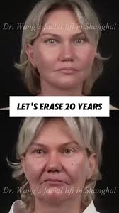 Datuk Dr Gary Chua 老千| TikTok