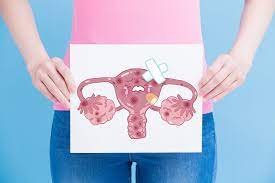 Te explicamos sus causas, síntomas y varias estrategias para prevenir este tipo de tumores. Historia De Mujer Sobreviviente De Cancer De Cuello Uterino Salud Eltiempo Com