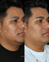 Eskra Plastic Surgery