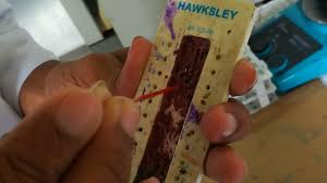 .separation, hematocrit reader, ez reader microhematocrit card lw scientific, hematocrit packed cell volume micro hematocrit tube reader thomas sci, hawksley readers and magnifiers, hematocrit. Manual Pcv Test Aladdin Creations