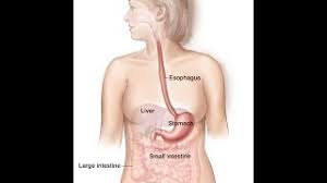 Likewise called gastric cancer, the disease usually grows slowly over several years. Symptoms Of Stomach Cancer In Tamil
