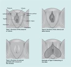 Exzision der klitoris mit partieller oder totaler amputation der kleinen schamlippen typ iii: Protecting Pupils From Female Genital Mutilation British Journal Of School Nursing
