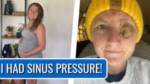 Young Mom Melanie's Stage 4 Nasal Squamous Cell Cancer