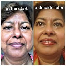 Anti-Ageing Skincare