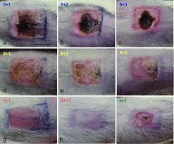 In this article, we'll define necrotic tissue and describe ways to effect its removal from the wound bed. Photographs Showing Partial Necrosis A B C I And Superficial Download Scientific Diagram