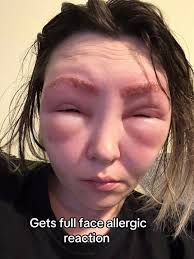 Don't forget your allergies. Full video coming soon. #fyp #newyear #al...