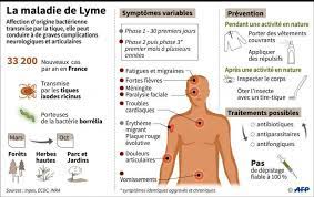 Pour acquérir ce trouble, il est donc nécessaire d'être en contact avec ces arthropodes. Les Nouvelles Recommandations Pour Lutter Contre La Maladie De Lyme Provoquent Des Polemiques