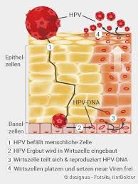 The first three most prevalent hpv types were hpv 6, 11, and 16. Hpv Ursachen Folgeerkrankungen Symptome Behandlung Netdoktor