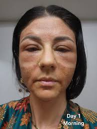 Any ideas for red and sore lumps