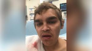 OFA 2024: Gnowangerup defeat Lake Grace-Pingrup in one-point thriller,  Newdegate ease past Boxwood Hill