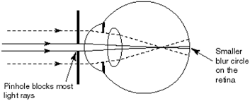 Image result for Pinhole Test