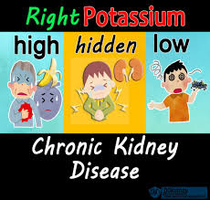 How To Use Potassium To Repair Your Kidneys The Smart Potassium Management Guide In 2020 Kidney Diet Kidney Disease Kidney